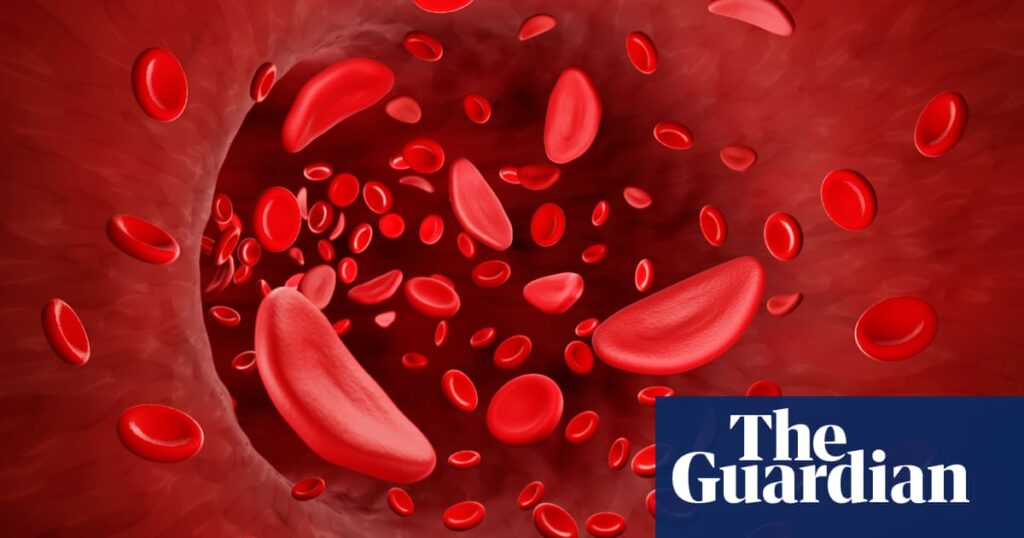 ‘What’s the worst that could happen?’: Love in the sickle cell capital of the world – podcast
